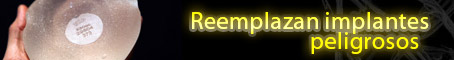 Reemplazan implantes peligrosos